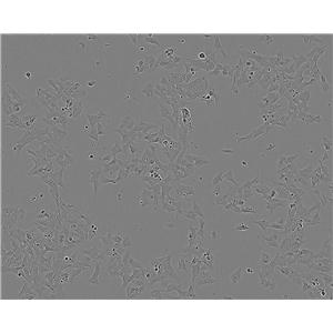 NMC-G1:人脑胶质复苏细胞(提供STR鉴定图谱)