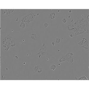 COS-7:SV40转化的非洲绿猴肾复苏细胞(提供STR鉴定图谱)