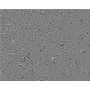 RGC-5:小鼠视网膜神经节复苏细胞(提供STR鉴定图谱)
