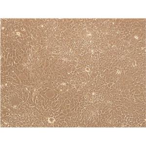 Ishikawa:人子宫内膜癌复苏细胞(提供STR鉴定图谱)