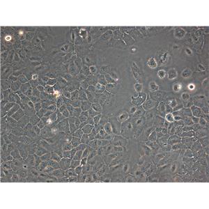 ARPE-19:人视网膜色素上皮复苏细胞(提供STR鉴定图谱)