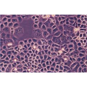 A-431:人皮肤鳞癌复苏细胞(提供STR鉴定图谱)