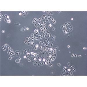 A2780:人卵巢癌复苏细胞(提供STR鉴定图谱)