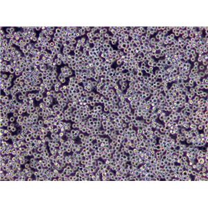 MDCC-MSB1 Cells(赠送Str鉴定报告)|鸡淋巴瘤细胞