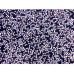 Karpas-299 Cells(赠送Str鉴定报告)|人间变性大细胞淋巴瘤细胞