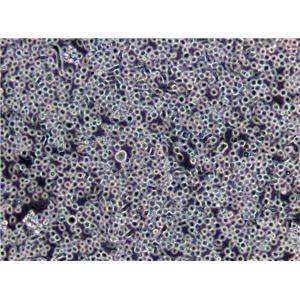 A20 Cells(赠送Str鉴定报告)|小鼠B细胞淋巴瘤细胞