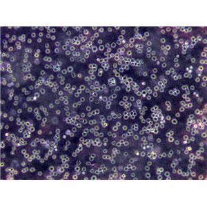 P116 Cells(赠送Str鉴定报告)|人急性淋巴白血病细胞