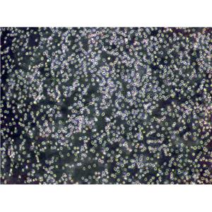 Jurkat Cells(赠送Str鉴定报告)|人急性T淋巴细胞白血病细胞,Jurkat Cells