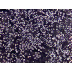 MC116 Cells(赠送Str鉴定报告)|人(未分化的)淋巴瘤细胞