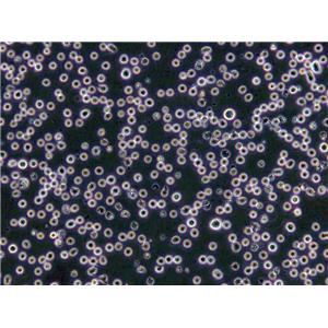 MJ Cells(赠送Str鉴定报告)|人皮肤T淋巴细胞瘤细胞