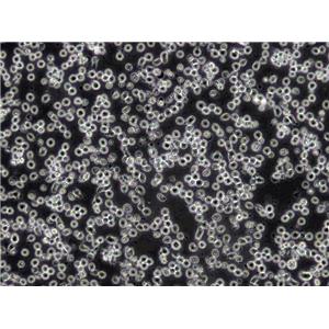 MOLT-4 Cells(赠送Str鉴定报告)|人急性淋巴母细胞性白血病细胞