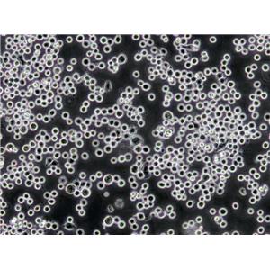 CCD-19Lu Cells(赠送Str鉴定报告)|人肺成纤维细胞,CCD-19Lu Cells