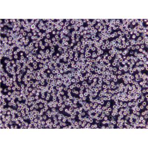 2BS Cells(赠送Str鉴定报告)|人胚肺成纤维细胞,2BS Cells