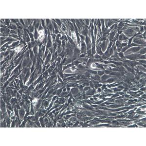 MOVAS-1 Cells(赠送Str鉴定报告)|小鼠主动脉平滑肌细胞