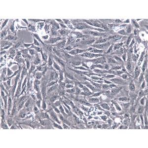 RA-FLSs Cells(赠送Str鉴定报告)|类风湿关节炎成纤维样滑膜细胞