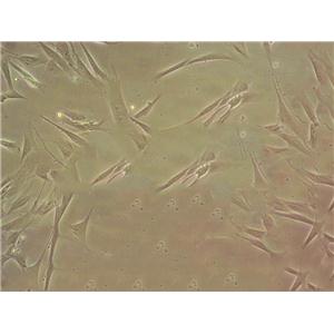 MH7A Cells(赠送Str鉴定报告)|关节炎成纤维细胞