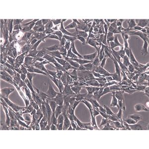 BALB/3T3 clone A31 Cells(赠送Str鉴定报告)|小鼠胚胎成纤维细胞