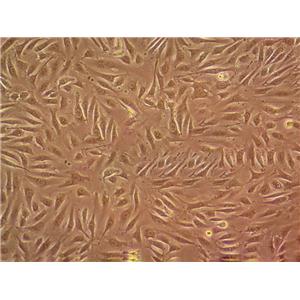 HLF Cells(赠送Str鉴定报告)|人肺成纤维样细胞