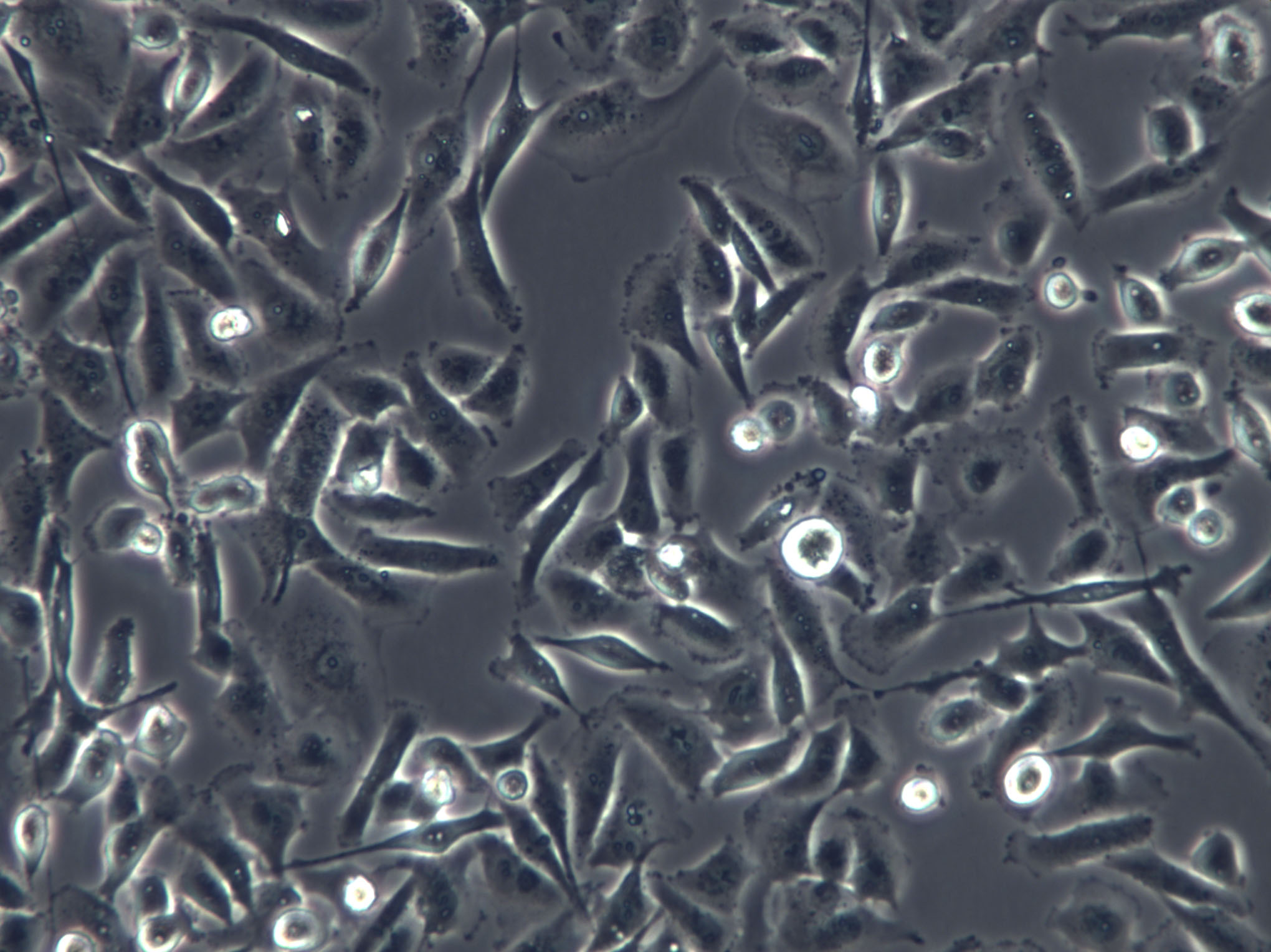 SNU-620 Cells(赠送Str鉴定报告)|人胃癌细胞,SNU-620 Cells
