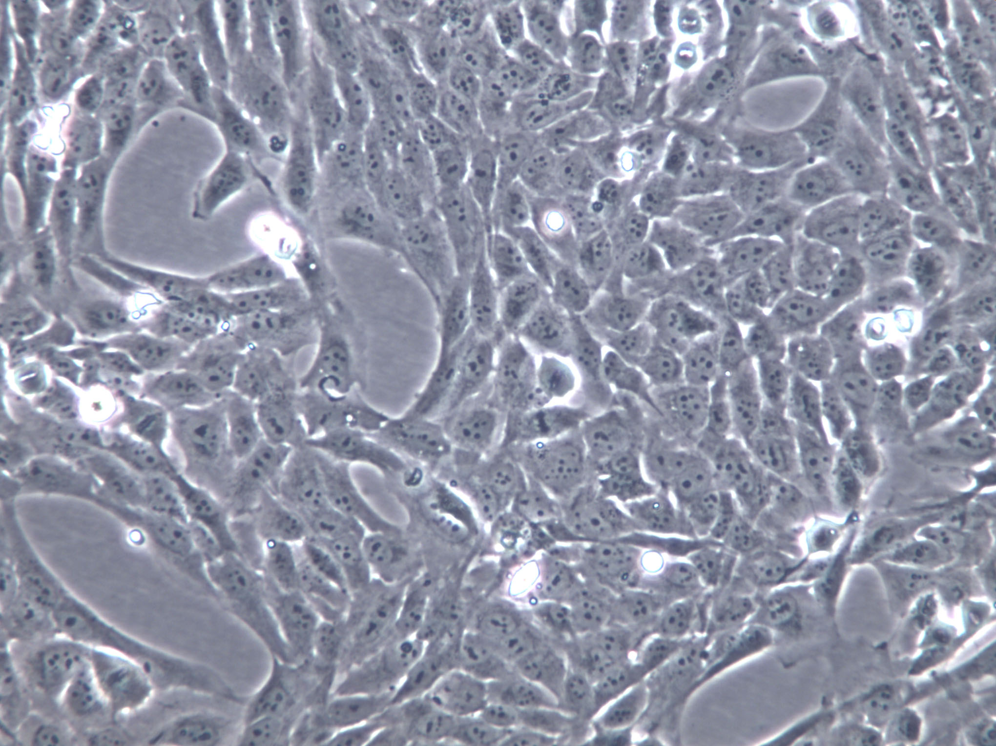 HARA-B Cells(赠送Str鉴定报告)|人肺癌鳞癌细胞,HARA-B Cells