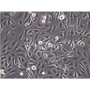 HCC2108 Cells(赠送Str鉴定报告)|人肺癌腺癌细胞