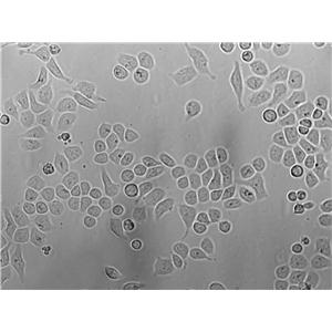 TE-12 Cells(赠送Str鉴定报告)|人食道癌肿瘤细胞