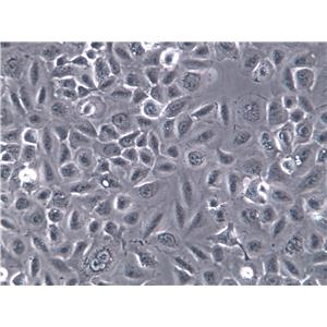 HCC1008 Cells(赠送Str鉴定报告)|人乳腺导管癌细胞