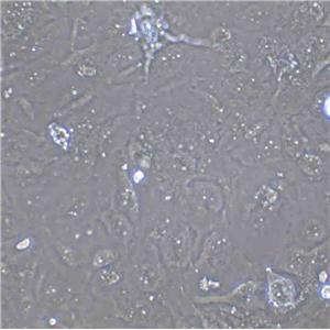 OKa-C-1 Cells(赠送Str鉴定报告)|人低分化肺癌鳞癌细胞