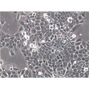 LUDLU-1 Cells(赠送Str鉴定报告)|人肺癌鳞癌细胞