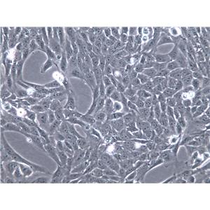 HARA-B Cells(赠送Str鉴定报告)|人肺癌鳞癌细胞