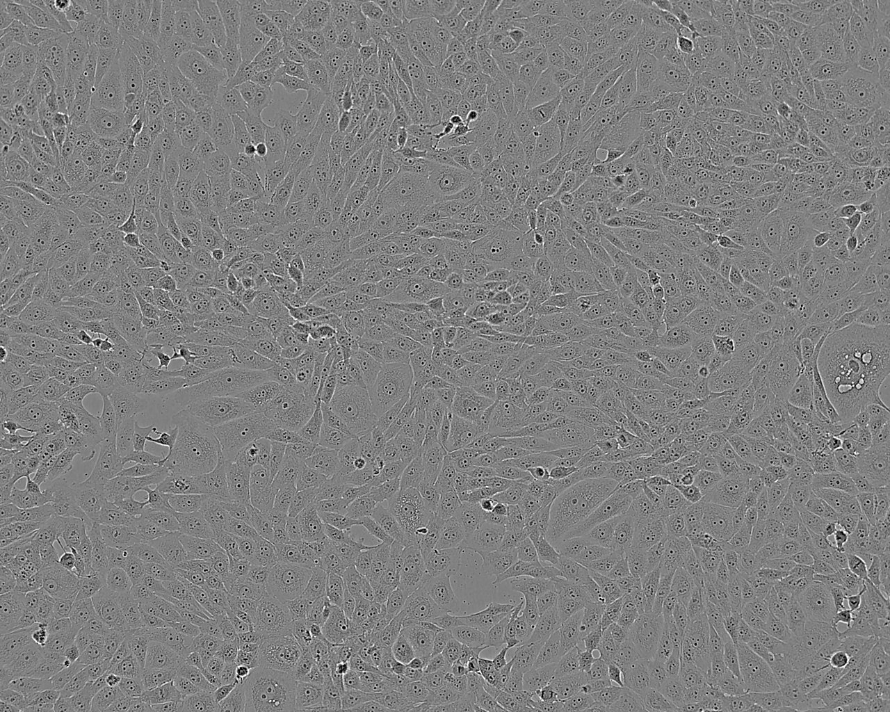 CHP-100 Cells|人成神经克隆细胞(包送STR鉴定报告),CHP-100 Cells