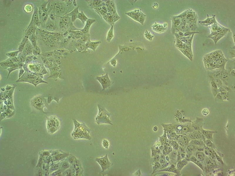 SK-N-BE(2)-M17 Cells|人成神经克隆细胞(包送STR鉴定报告),SK-N-BE(2)-M17 Cells