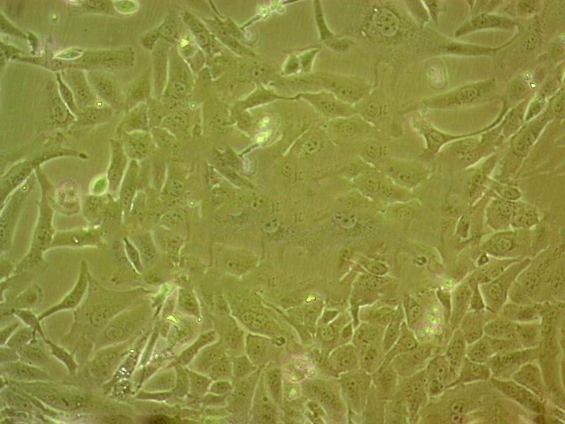 OVCA432 Cells|人卵巢癌克隆細胞(包送STR鑒定報告),OVCA432 Cells