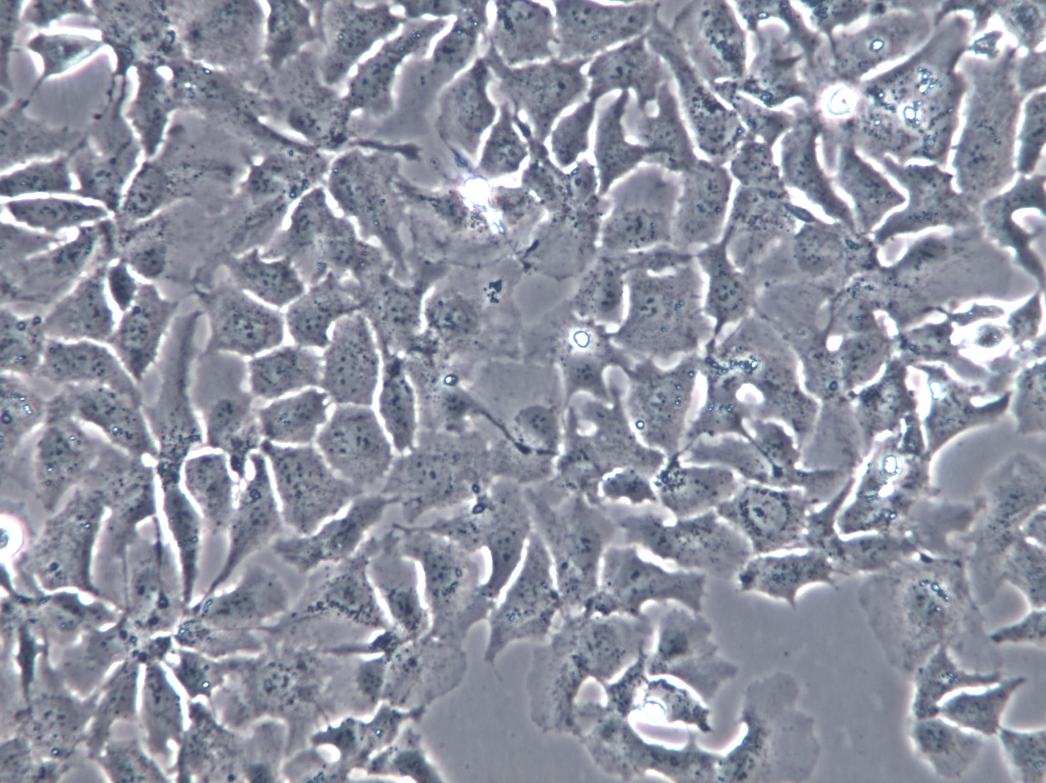 HEL-1 Cells|人胚肺二倍体克隆细胞(包送STR鉴定报告),HEL-1 Cells