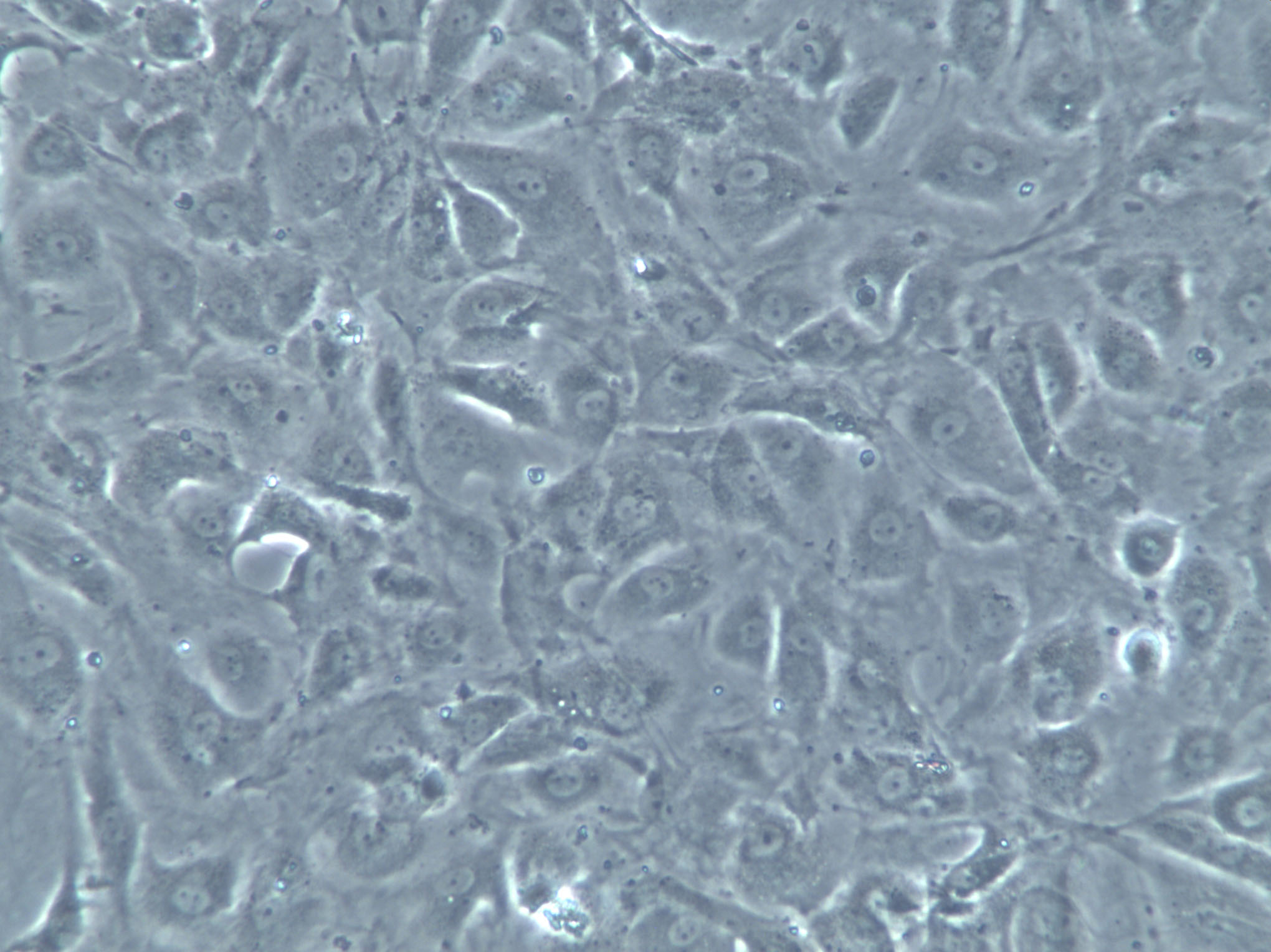 LP-1 Cells|人多发性骨髓瘤白克隆细胞(包送STR鉴定报告),LP-1 Cells