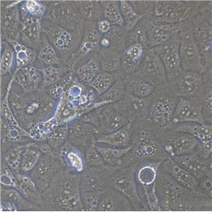 HEK-2 Cells|人胚肾二倍体克隆细胞(包送STR鉴定报告)