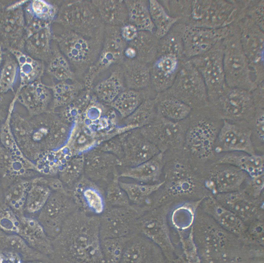 HEL 92.1.7 Cells(赠送Str鉴定报告)|人白血病细胞,HEL 92.1.7 Cells