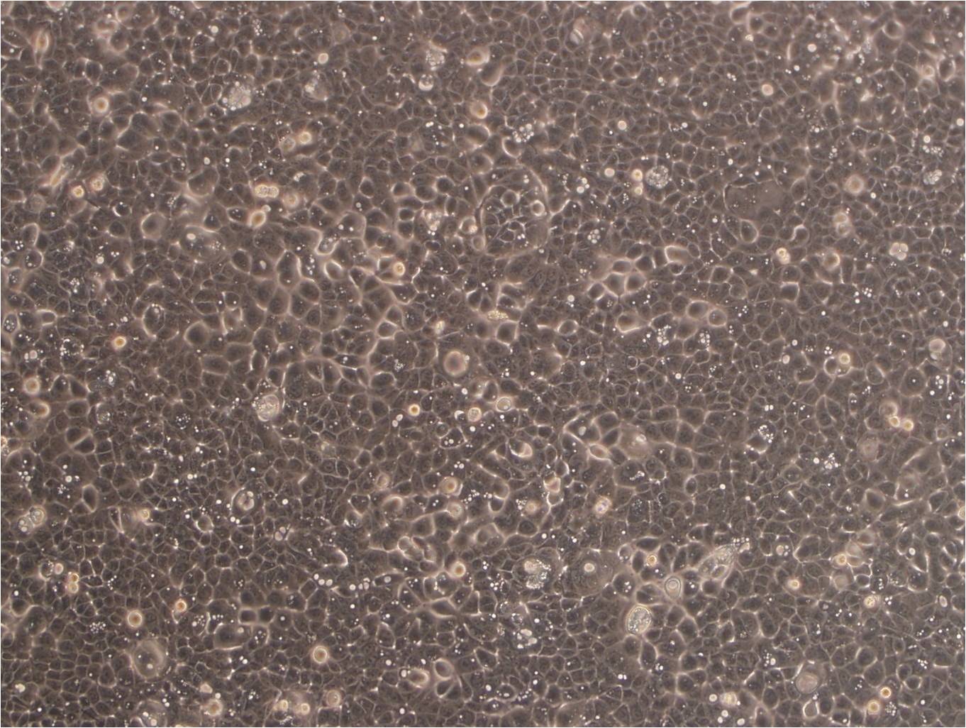 LS180 Cells(贈(zèng)送Str鑒定報(bào)告)|人結(jié)腸腺癌細(xì)胞,LS180 Cells