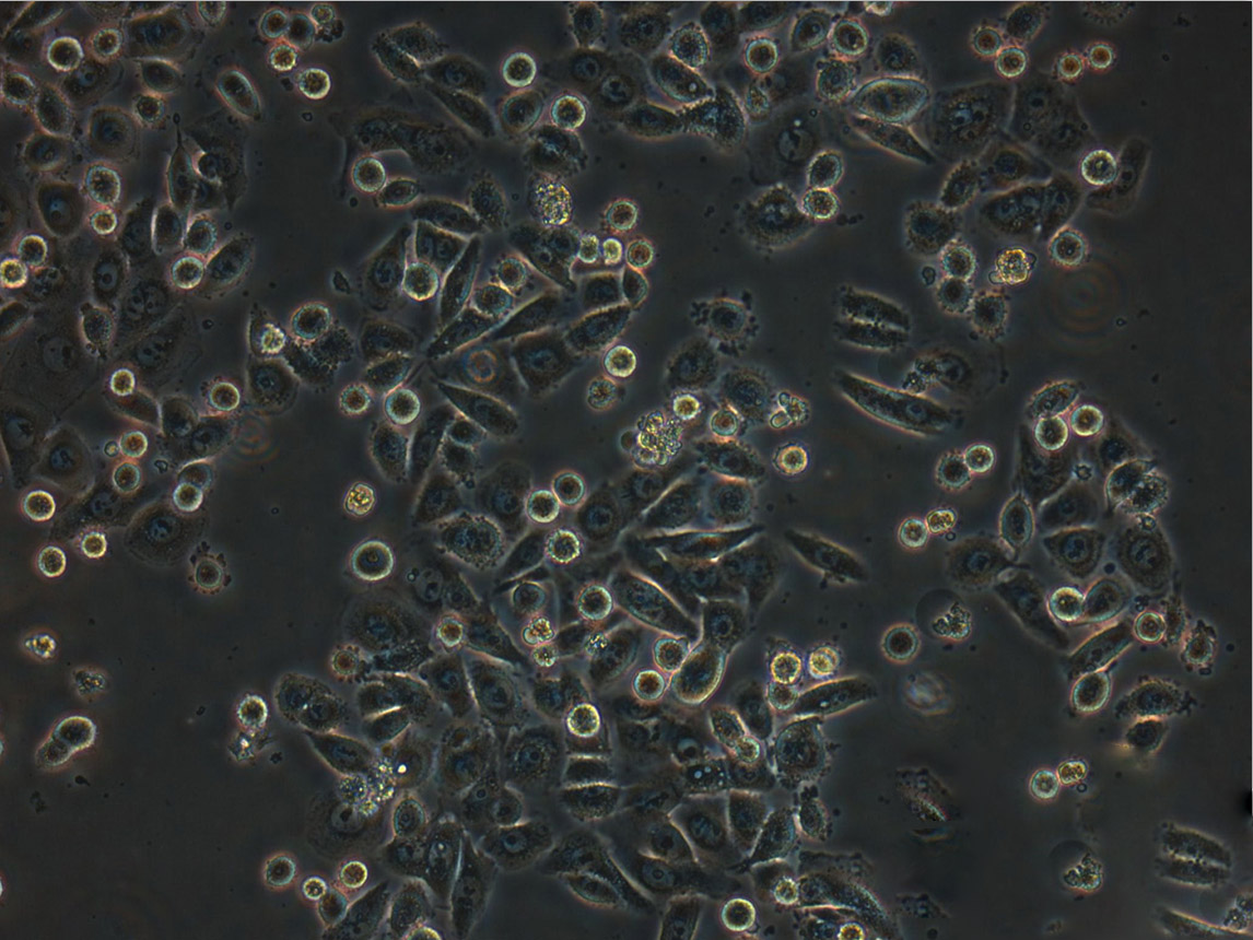 LA-N-6 Cells(赠送Str鉴定报告)|人神经母细胞,LA-N-6 Cells