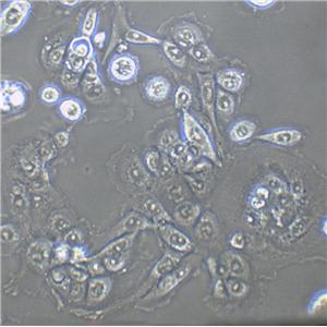 JCA-1 Cells(赠送Str鉴定报告)|人前列腺癌细胞