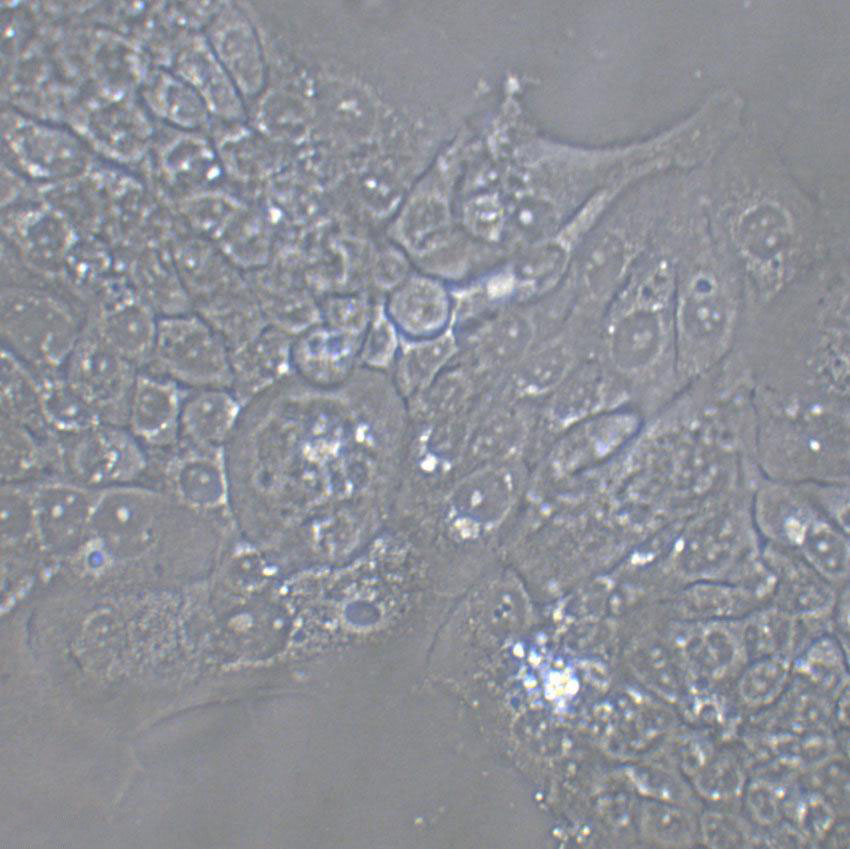 KLM-1 Cells(赠送Str鉴定报告)|人胰腺癌细胞,KLM-1 Cells