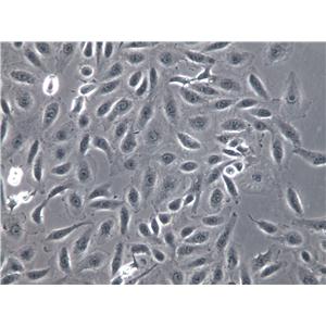 HCC9724 Cells(赠送Str鉴定报告)|人肝癌细胞