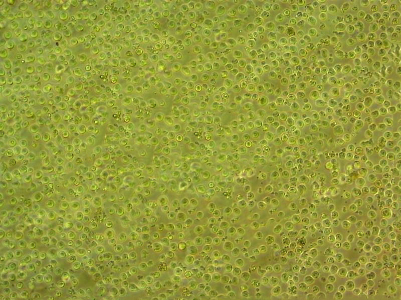 Daudi Cells|人Burkkit淋巴瘤克隆细胞(包送STR鉴定报告),Daudi Cells