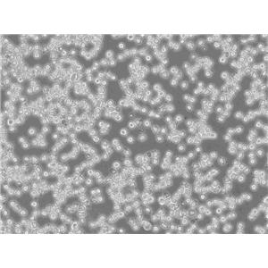 Kasumi-6 Cells|急性髓系细胞白血病克隆细胞(包送STR鉴定报告)