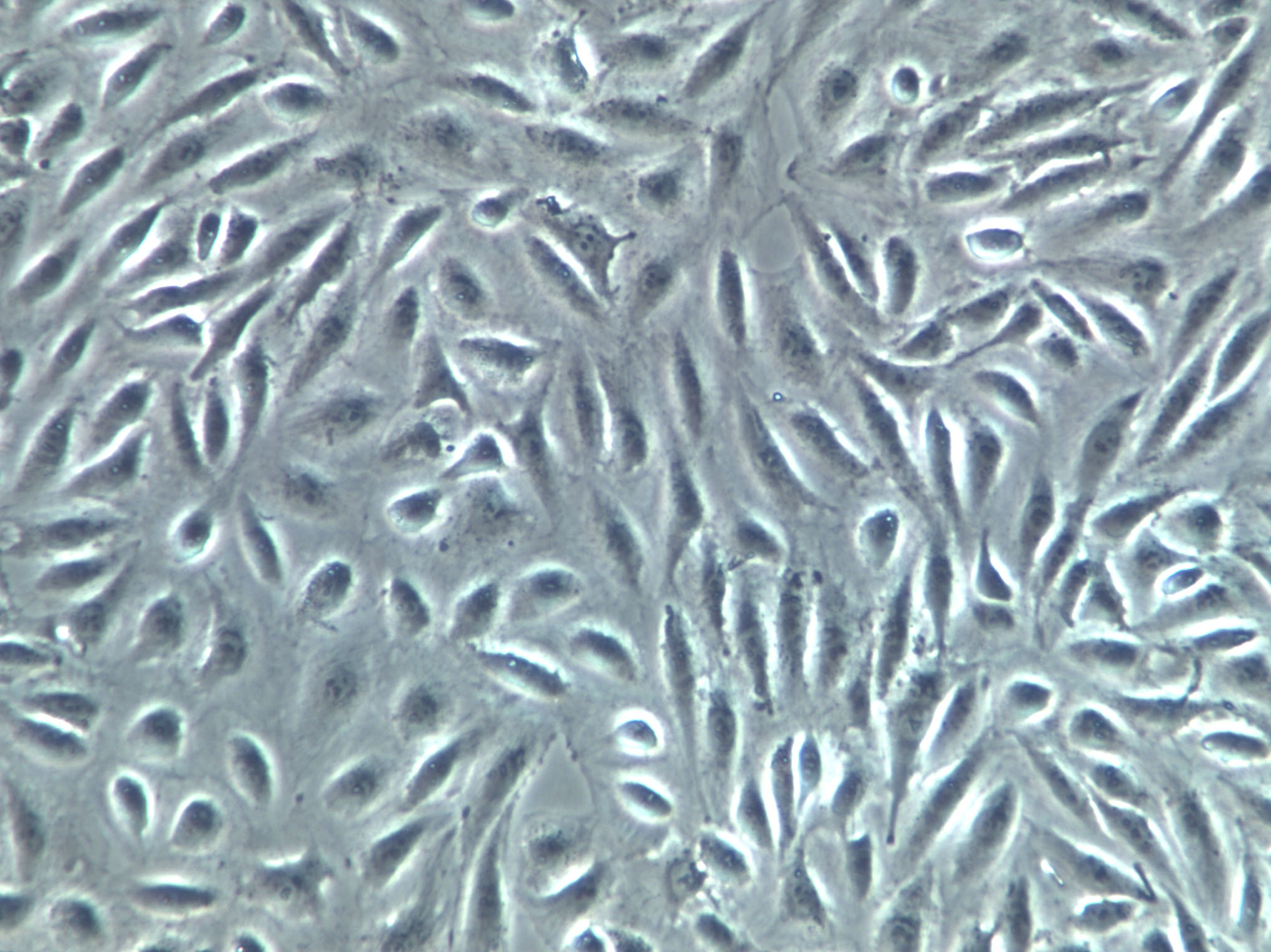 NCI-H650 Cells|人非小细胞肺癌克隆细胞(包送STR鉴定报告),NCI-H650 Cells
