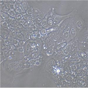 NCI-H1836 Cells|人小细胞肺癌克隆细胞(包送STR鉴定报告),NCI-H1836 Cells