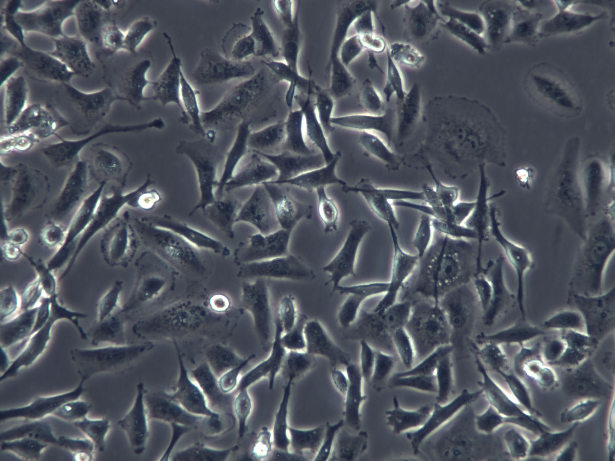 COV504 Cells|人卵巢癌克隆细胞,COV504 Cells