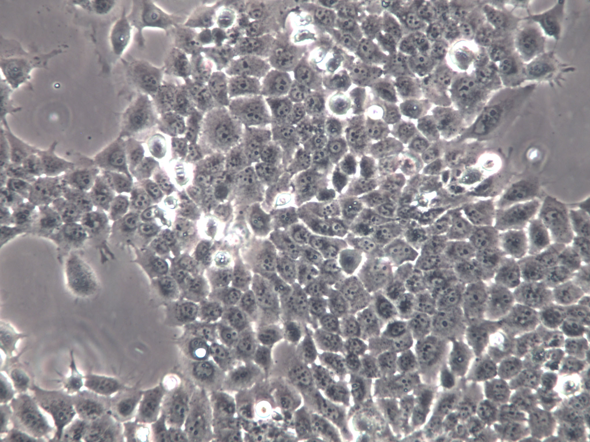 TSCC1 Cells(赠送Str鉴定报告)|人源口腔鳞状细胞,TSCC1 Cells