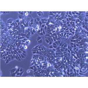 Capan-1 Cells|人胰腺癌克隆细胞,Capan-1 Cells