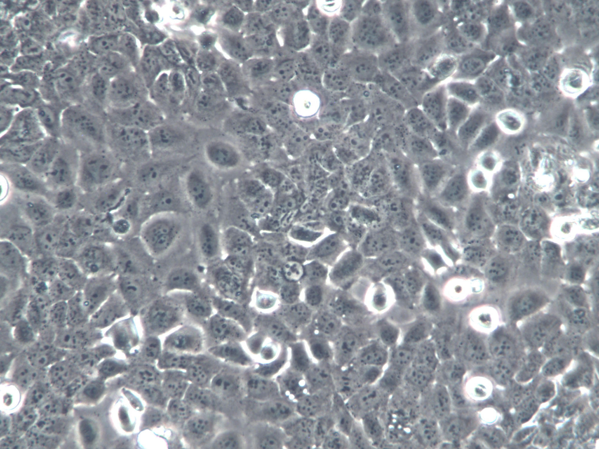 MADB106 Cells(赠送Str鉴定报告)|大鼠乳腺癌细胞,MADB106 Cells